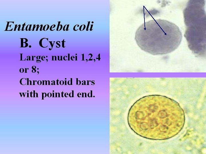 Entamoeba coli B. Cyst Large; nuclei 1, 2, 4 or 8; Chromatoid bars with