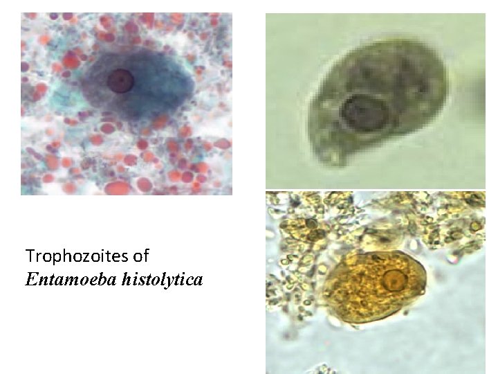Trophozoites of Entamoeba histolytica 