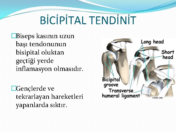 BİCİPİTAL TENDİNİT �Biseps kasının uzun başı tendonunun bisipital oluktan geçtiği yerde inflamasyon olmasıdır. �Gençlerde