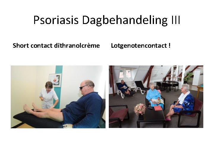 Psoriasis Dagbehandeling III Short contact dithranolcrème Lotgenotencontact ! 