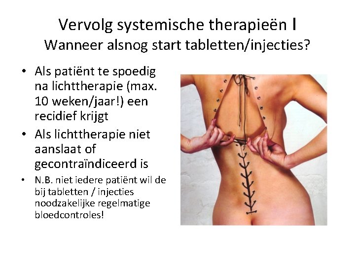 Vervolg systemische therapieën I Wanneer alsnog start tabletten/injecties? • Als patiënt te spoedig na