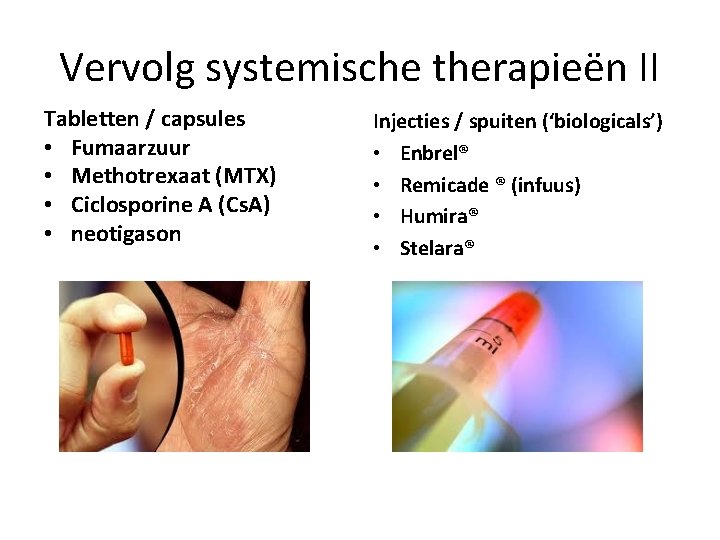 Vervolg systemische therapieën II Tabletten / capsules • Fumaarzuur • Methotrexaat (MTX) • Ciclosporine