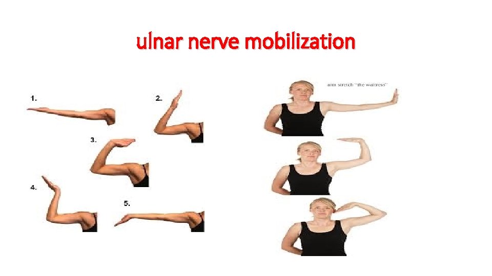 ulnar nerve mobilization 