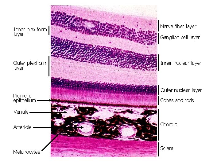 Inner plexiform layer Outer plexiform layer Pigment epithelium Nerve fiber layer Ganglion cell layer