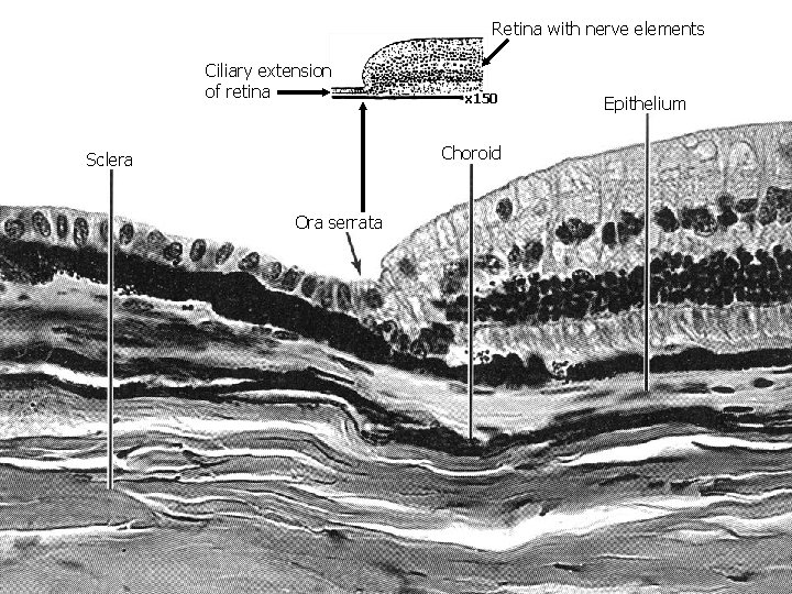 Retina with nerve elements Ciliary extension of retina x 150 Choroid Sclera Ora serrata