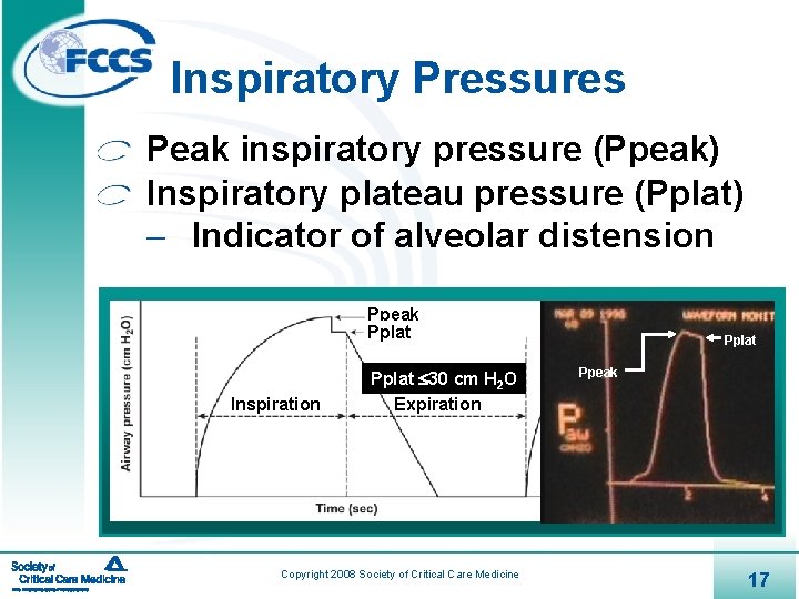 Inspiratory Pressures Peak inspiratory pressure (Ppeak) Inspiratory plateau pressure (Pplat) - Indicator of alveolar
