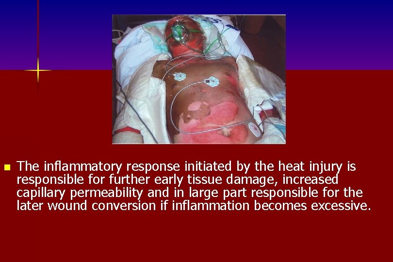 n The inflammatory response initiated by the heat injury is responsible for further early