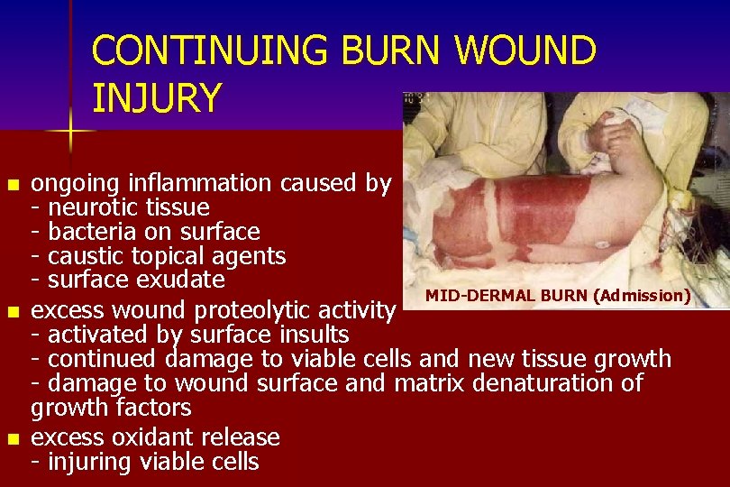 CONTINUING BURN WOUND INJURY n n n ongoing inflammation caused by - neurotic tissue