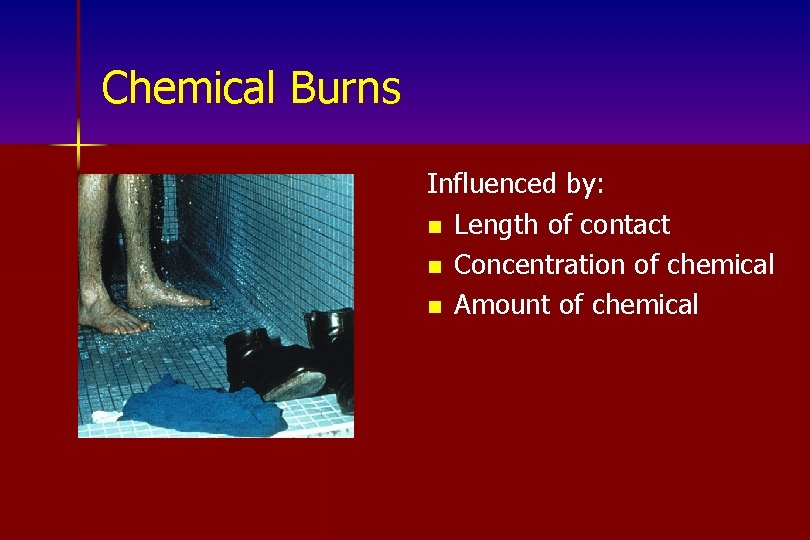 Chemical Burns Influenced by: n Length of contact n Concentration of chemical n Amount