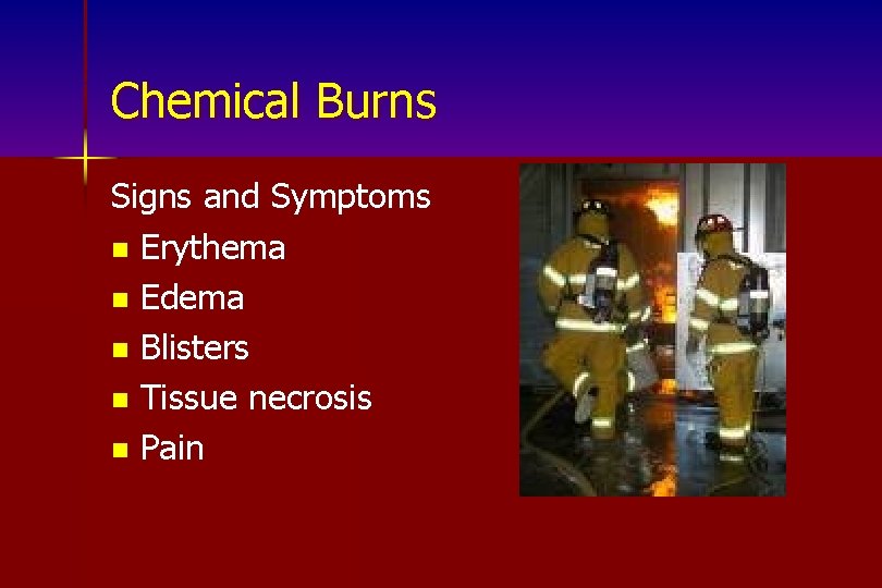 Chemical Burns Signs and Symptoms n Erythema n Edema n Blisters n Tissue necrosis