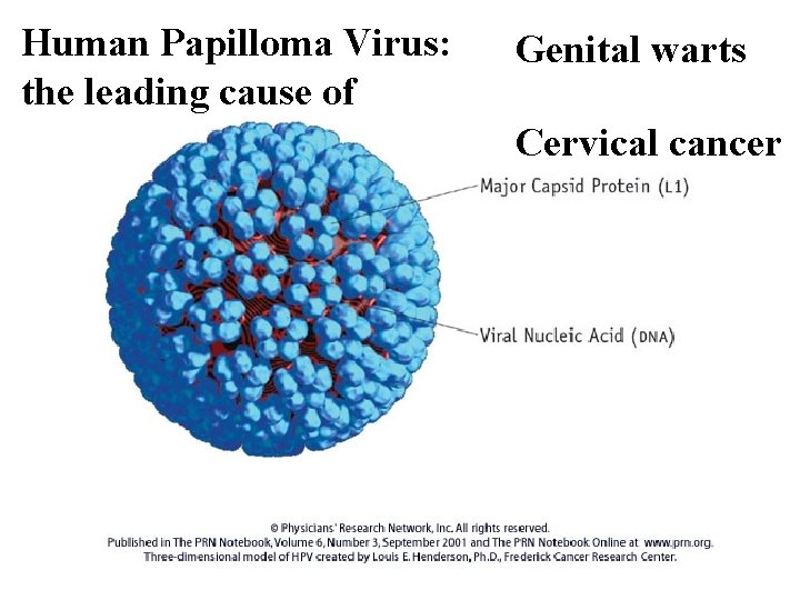Human Papilloma Virus: the leading cause of Genital warts Cervical cancer 