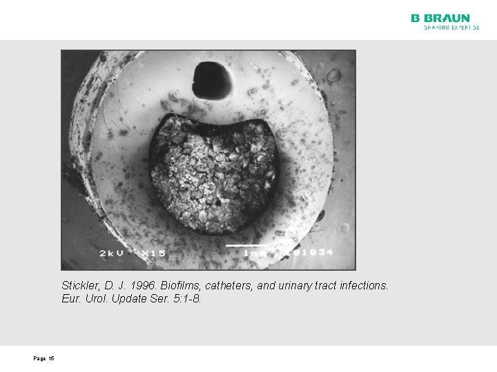 Stickler, D. J. 1996. Biofilms, catheters, and urinary tract infections. Eur. Urol. Update Ser.