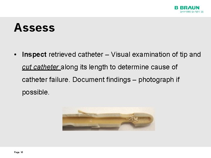Assess • Inspect retrieved catheter – Visual examination of tip and cut catheter along
