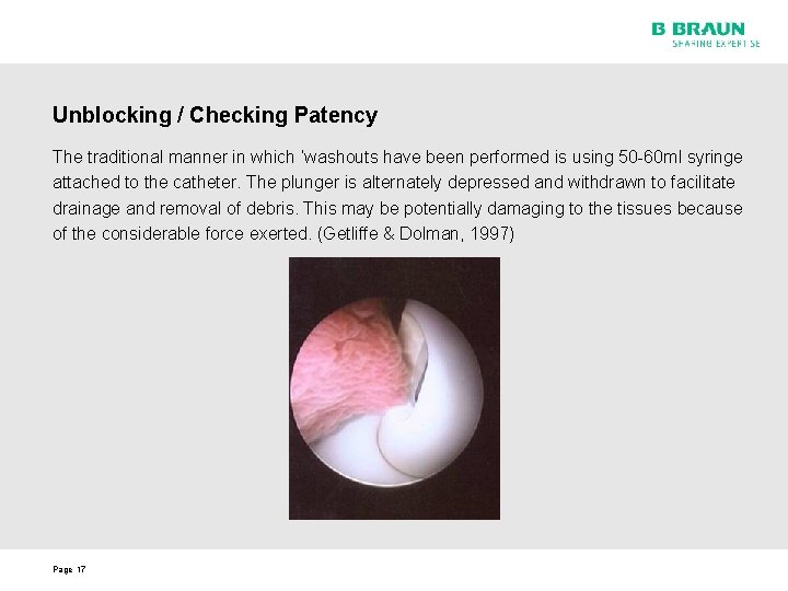 Unblocking / Checking Patency The traditional manner in which ‘washouts have been performed is