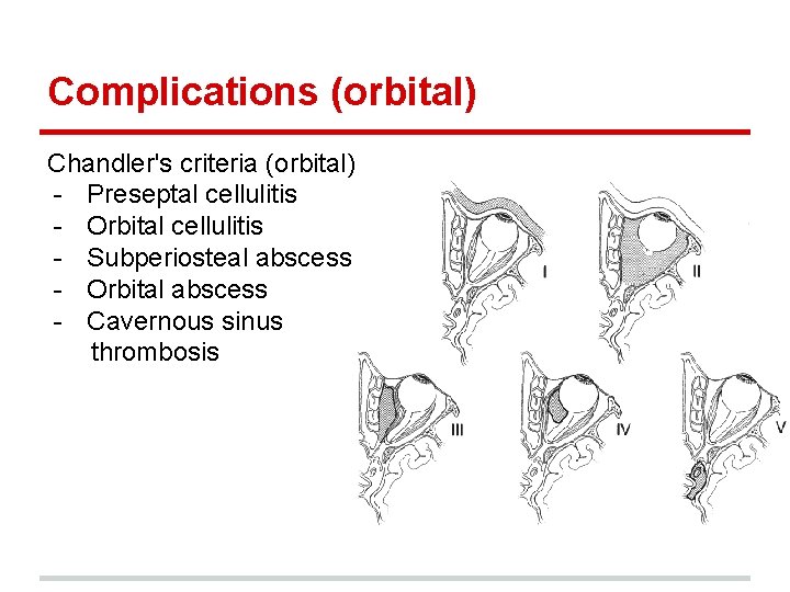 Complications (orbital) Chandler's criteria (orbital) - Preseptal cellulitis - Orbital cellulitis - Subperiosteal abscess