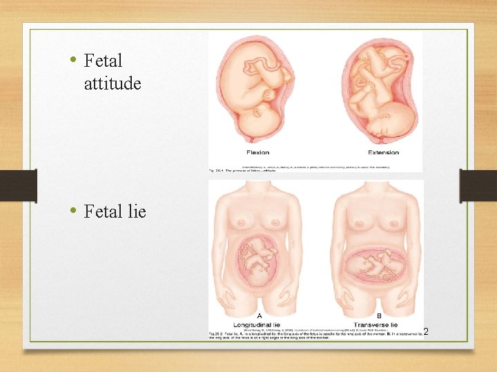  • Fetal attitude • Fetal lie 10/24/2021 12 