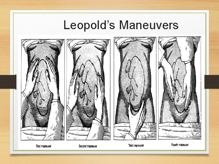 Leopold’s Maneuvers 10/24/2021 22 