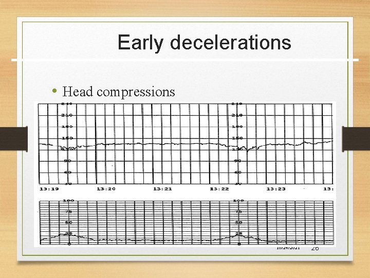 Early decelerations • Head compressions 10/24/2021 26 