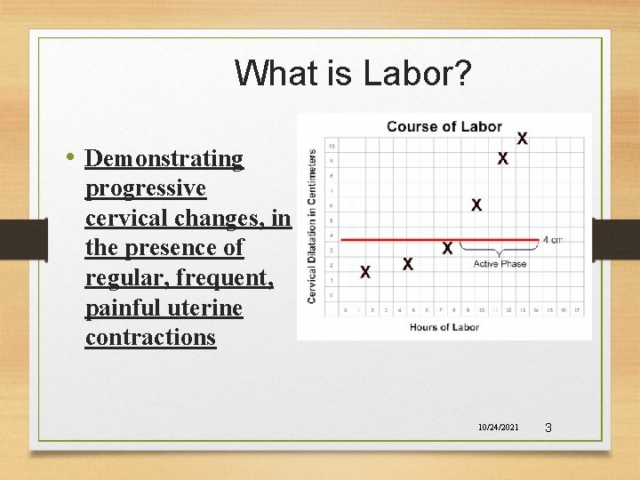 What is Labor? • Demonstrating progressive cervical changes, in the presence of regular, frequent,