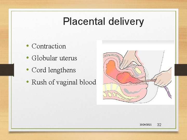 Placental delivery • • Contraction Globular uterus Cord lengthens Rush of vaginal blood 10/24/2021