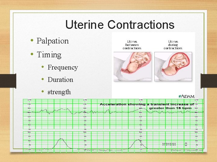 Uterine Contractions • Palpation • Timing • Frequency • Duration • strength 10/24/2021 8