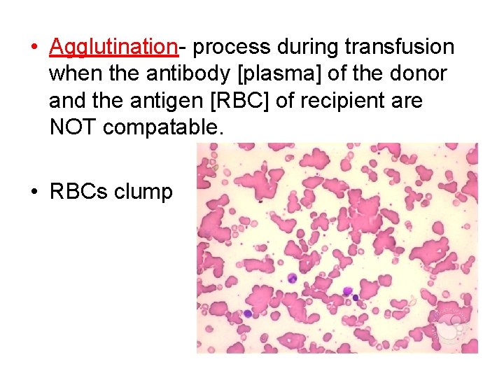  • Agglutination- process during transfusion when the antibody [plasma] of the donor and