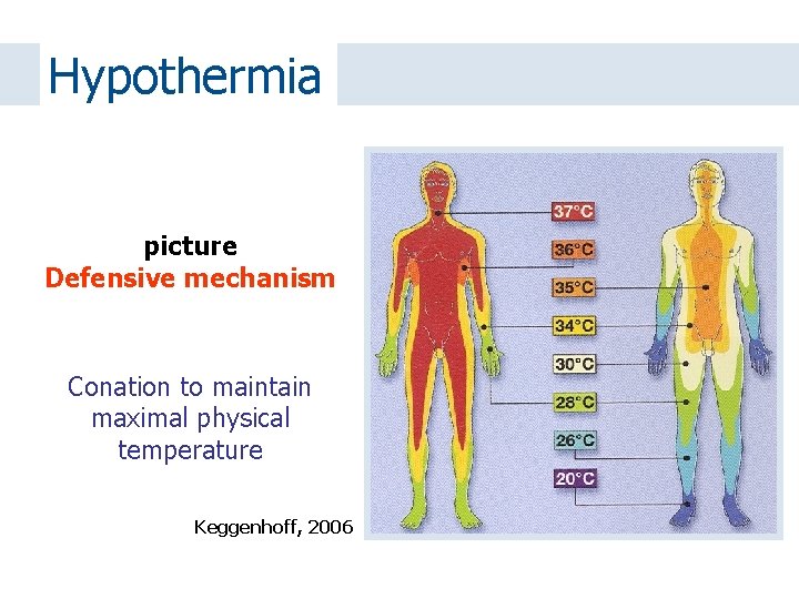 Hypothermia picture Defensive mechanism Conation to maintain maximal physical temperature Keggenhoff, 2006 