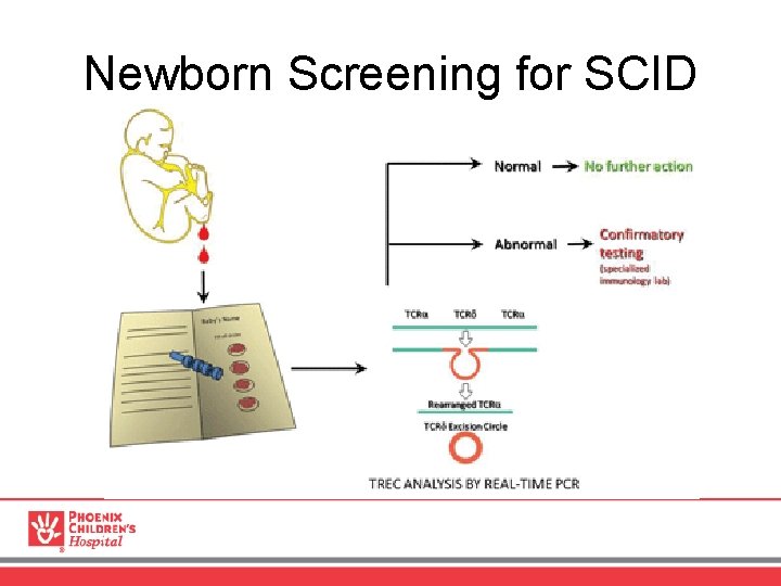 Newborn Screening for SCID 