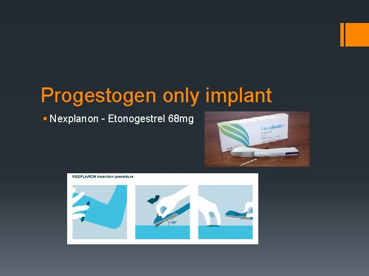 Progestogen only implant § Nexplanon – Etonogestrel 68 mg 