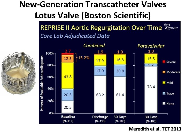 New-Generation Transcatheter Valves Lotus Valve (Boston Scientific) Meredith et al. TCT 2013 