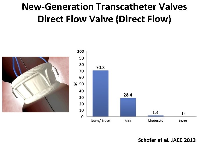New-Generation Transcatheter Valves Direct Flow Valve (Direct Flow) Schofer et al. JACC 2013 
