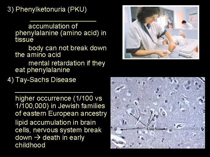 3) Phenylketonuria (PKU) _________ accumulation of phenylalanine (amino acid) in tissue body can not