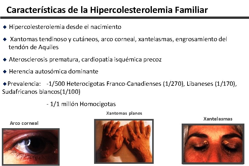 Características de la Hipercolesterolemia Familiar ¨ Hipercolesterolemia desde el nacimiento ¨ Xantomas tendinoso y
