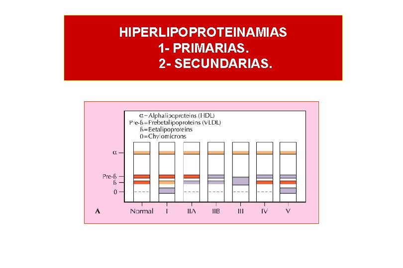HIPERLIPOPROTEINAMIAS 1 - PRIMARIAS. 2 - SECUNDARIAS. 