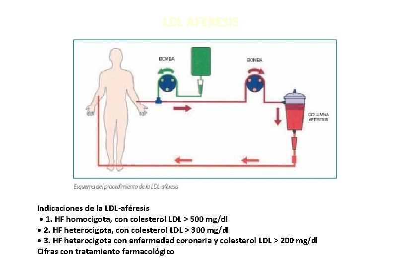 LDL AFERESIS Indicaciones de la LDL-aféresis • 1. HF homocigota, con colesterol LDL >
