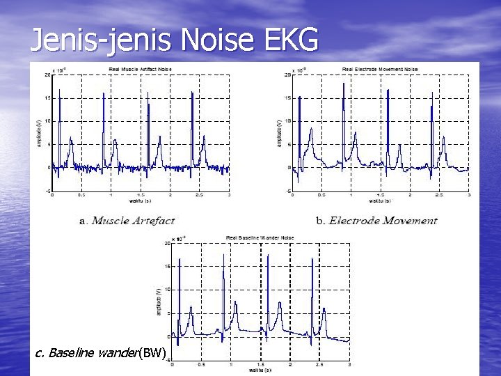 Jenis-jenis Noise EKG c. Baseline wander(BW) 