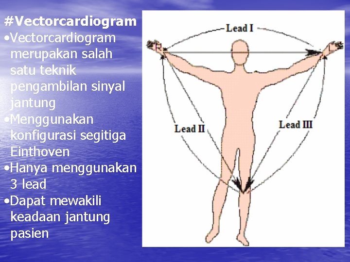 #Vectorcardiogram • Vectorcardiogram merupakan salah satu teknik pengambilan sinyal jantung • Menggunakan konfigurasi segitiga