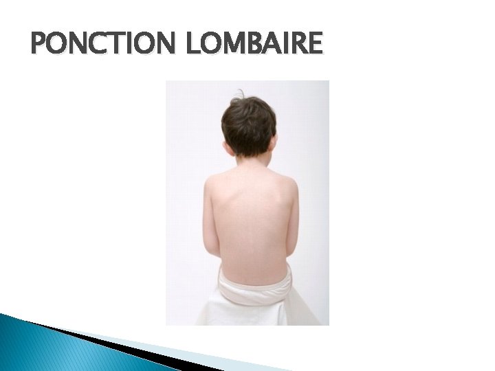 PONCTION LOMBAIRE 