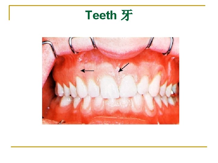 Teeth 牙 