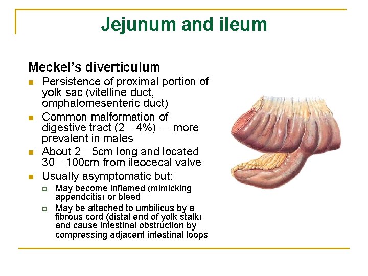 Jejunum and ileum Meckel’s diverticulum n n Persistence of proximal portion of yolk sac