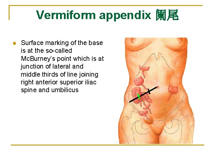 Vermiform appendix 阑尾 n Surface marking of the base is at the so-called Mc.