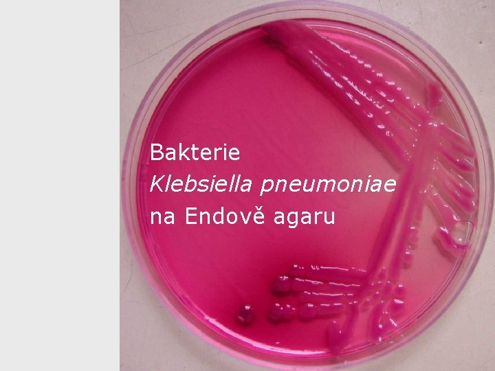 Bakterie Klebsiella pneumoniae na Endově agaru 