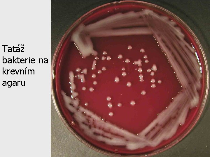 Tatáž bakterie na krevním agaru 