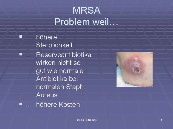 MRSA Problem weil… § … höhere Sterblichkeit § … Reserveantibiotika wirken nicht so gut