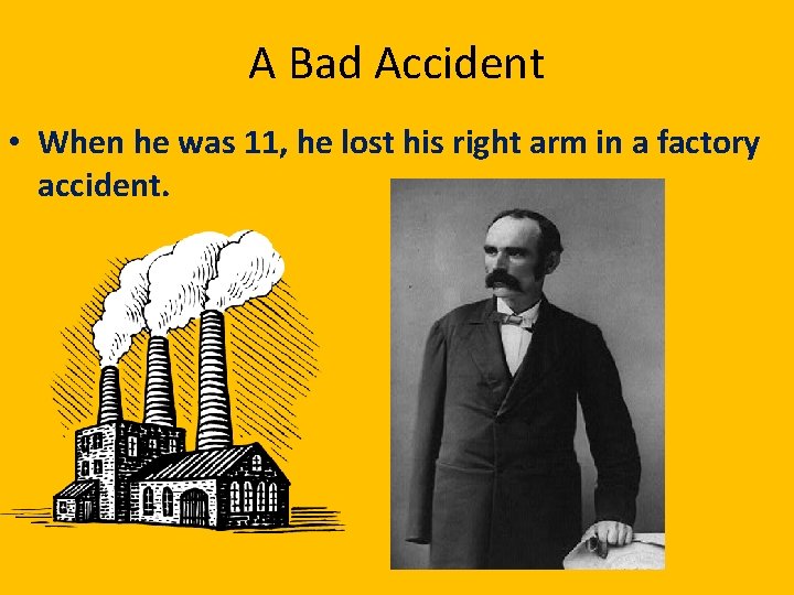 A Bad Accident • When he was 11, he lost his right arm in