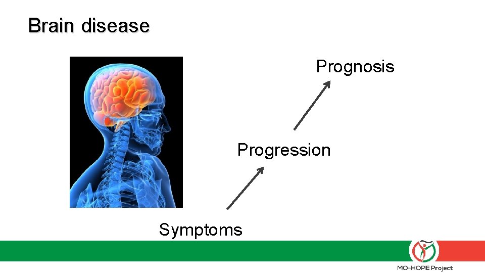 Brain disease Prognosis Progression Symptoms 