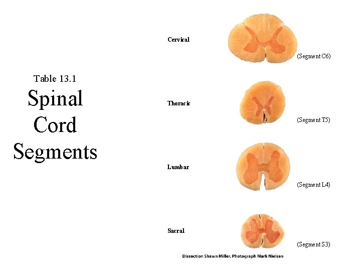 Cervical (Segment C 6) Table 13. 1 Spinal Cord Segments Thoracic (Segment T 5)