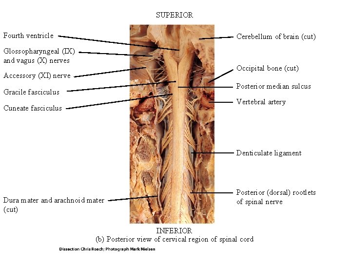 SUPERIOR Fourth ventricle Cerebellum of brain (cut) Glossopharyngeal (IX) and vagus (X) nerves Occipital