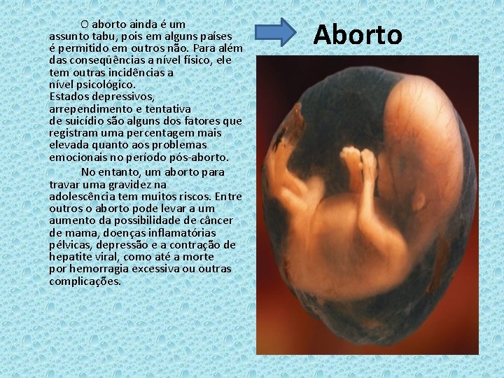 O aborto ainda é um assunto tabu, pois em alguns países é permitido em