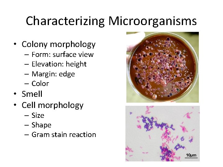 Characterizing Microorganisms • Colony morphology – Form: surface view – Elevation: height – Margin: